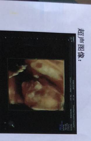 journal_insert_pic_988852450