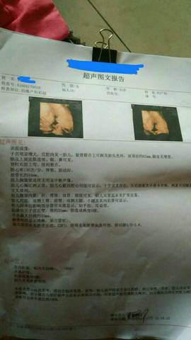 journal_insert_pic_991881157