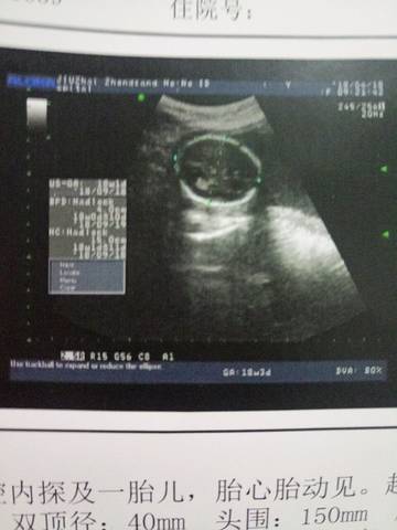 journal_insert_pic_992823983