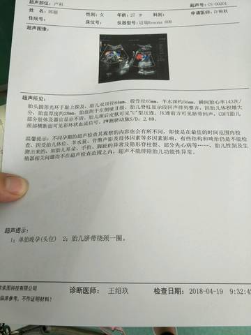 journal_insert_pic_993007634