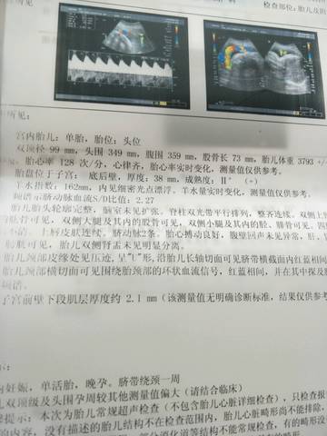 journal_insert_pic_993841707