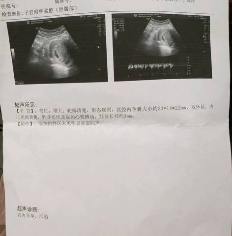 journal_insert_pic_994722022