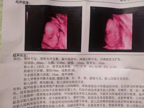 journal_insert_pic_994589300