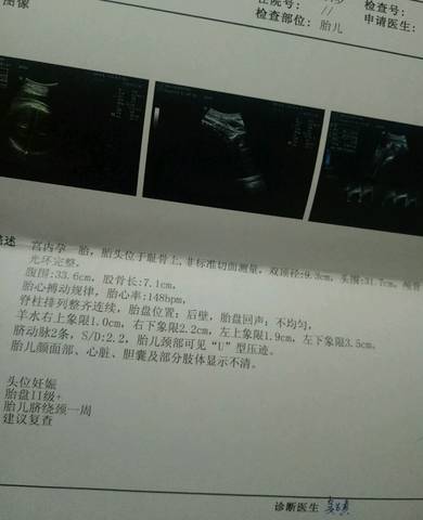 journal_insert_pic_995707358