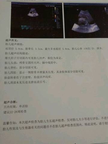 journal_insert_pic_996275683
