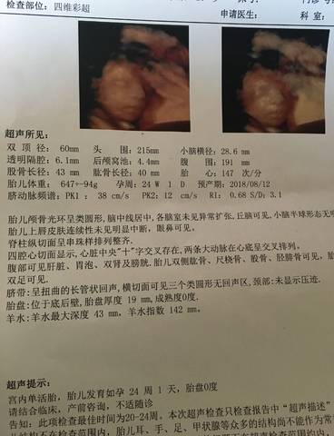 journal_insert_pic_996210734