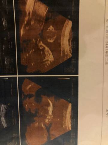 journal_insert_pic_997141191