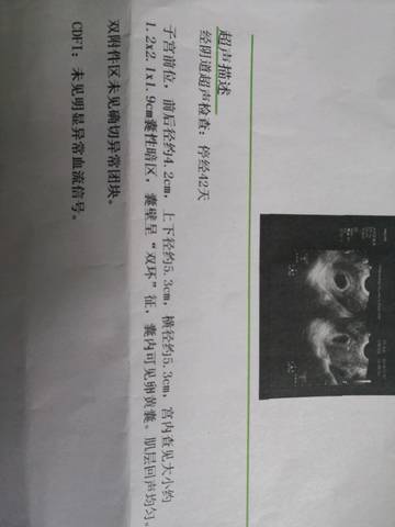journal_insert_pic_998887644