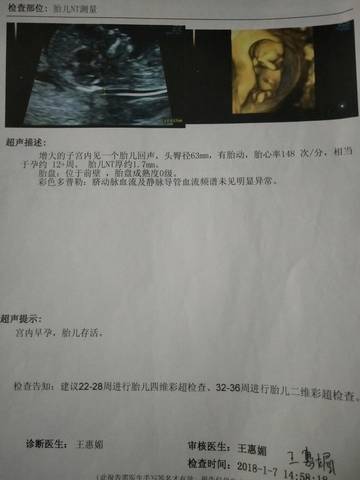 journal_insert_pic_998735048