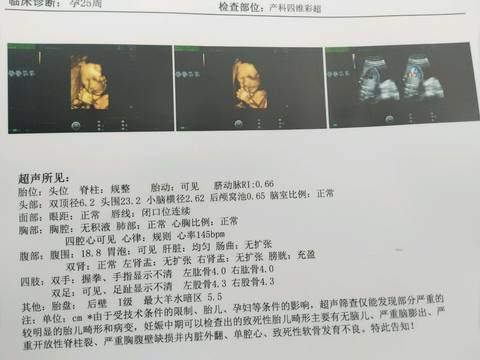 journal_insert_pic_999837736