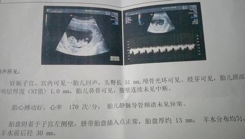 journal_insert_pic_999556144