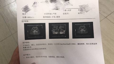 journal_insert_pic_1000411407