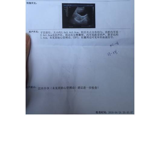 journal_insert_pic_1000113198