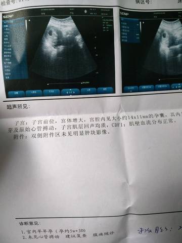 journal_insert_pic_1001932957