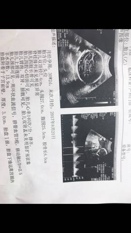 journal_insert_pic_1001949295