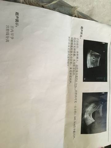 journal_insert_pic_1002605798