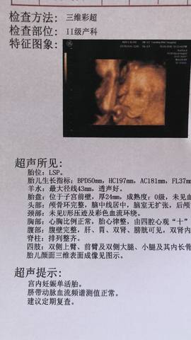 journal_insert_pic_1002771371