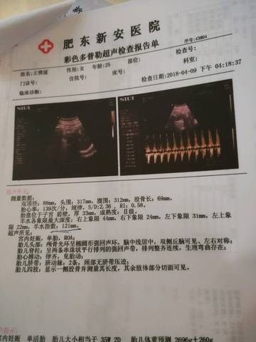 journal_insert_pic_1004472010