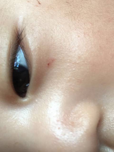 宝宝三个月了,今天发现它左眼黑眼球中间有一个白点