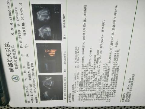 journal_insert_pic_1004290793