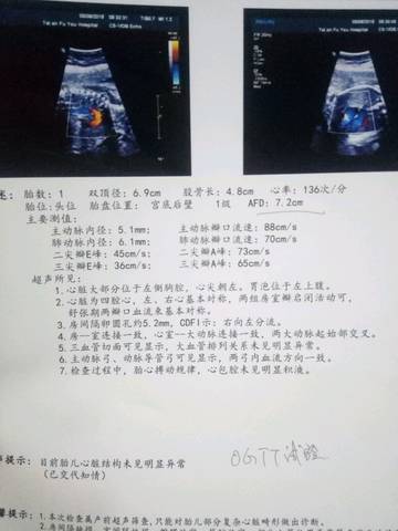 journal_insert_pic_1005871598