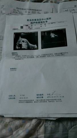 journal_insert_pic_1006766636