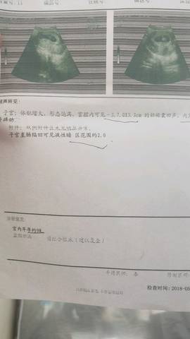journal_insert_pic_1006369252