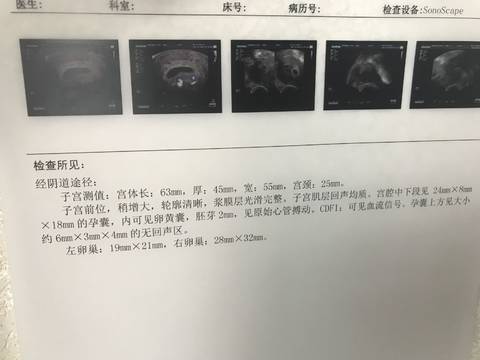 journal_insert_pic_1008684185