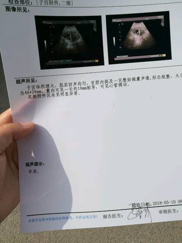 journal_insert_pic_1008485020