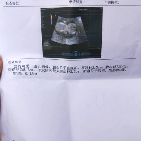 journal_insert_pic_1009206624