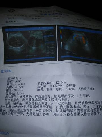 journal_insert_pic_1011045480