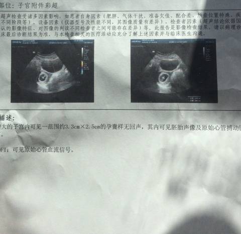 journal_insert_pic_1011731538
