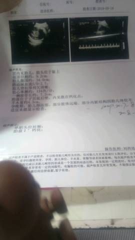 journal_insert_pic_1013090178