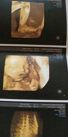 journal_insert_pic_1013070876