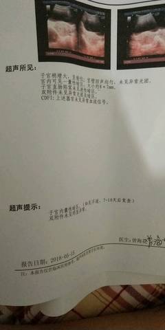 journal_insert_pic_1012979863