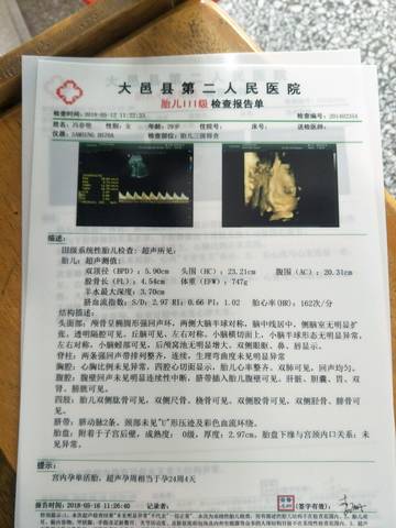 journal_insert_pic_1012920223