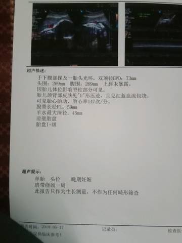 journal_insert_pic_1014090806