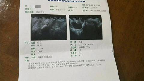 journal_insert_pic_1015440434
