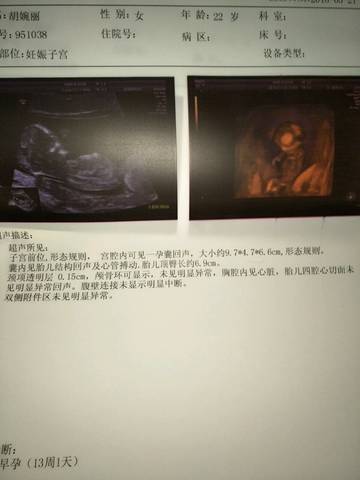 journal_insert_pic_1016485355