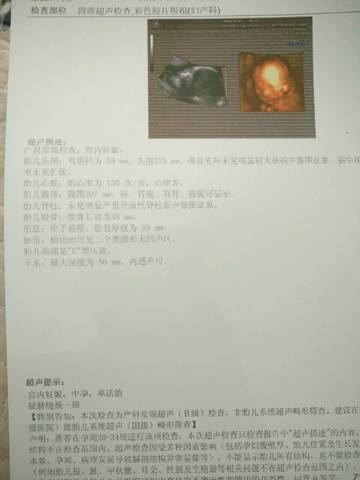 journal_insert_pic_1016915430