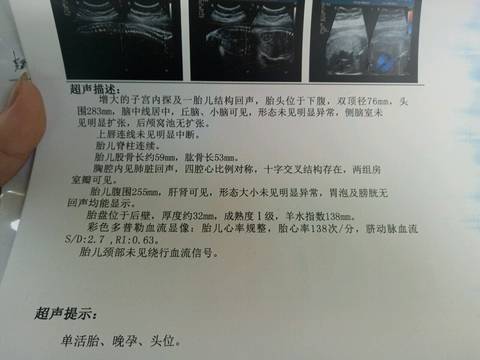 journal_insert_pic_1017881253