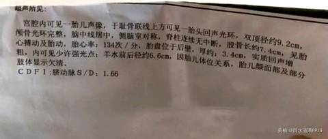 journal_insert_pic_1021358843
