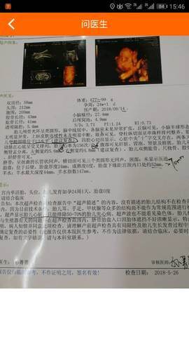 journal_insert_pic_1020949959