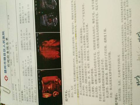 journal_insert_pic_1021310539