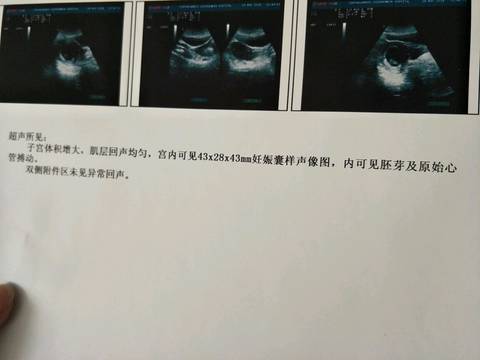 journal_insert_pic_1022648437