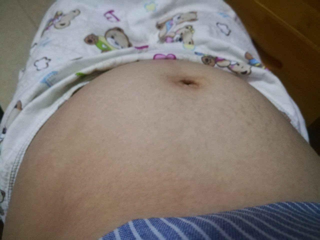 一个多月肚子就那么大，正常吗？现在怀的是二胎。