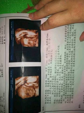 journal_insert_pic_1024316662