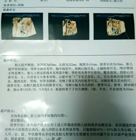 journal_insert_pic_1024538449