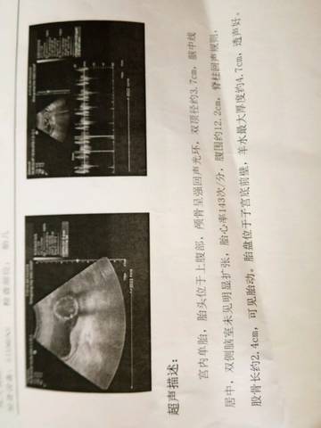 journal_insert_pic_1025683136