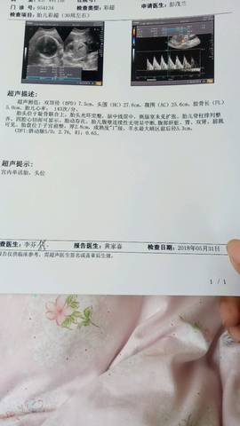 journal_insert_pic_1026402198